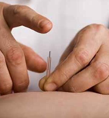 Acupuncture practitioner, inserting a needle into patient