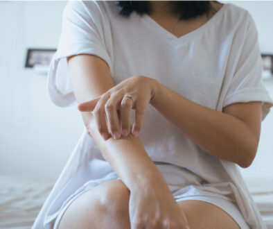 Woman with Psoriasis Sitting on a Table